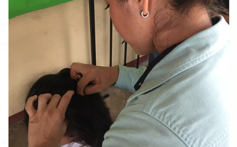 Alertan Ante Casos De Piojos En Escuelas De Quintana Roo Desde El Balcon